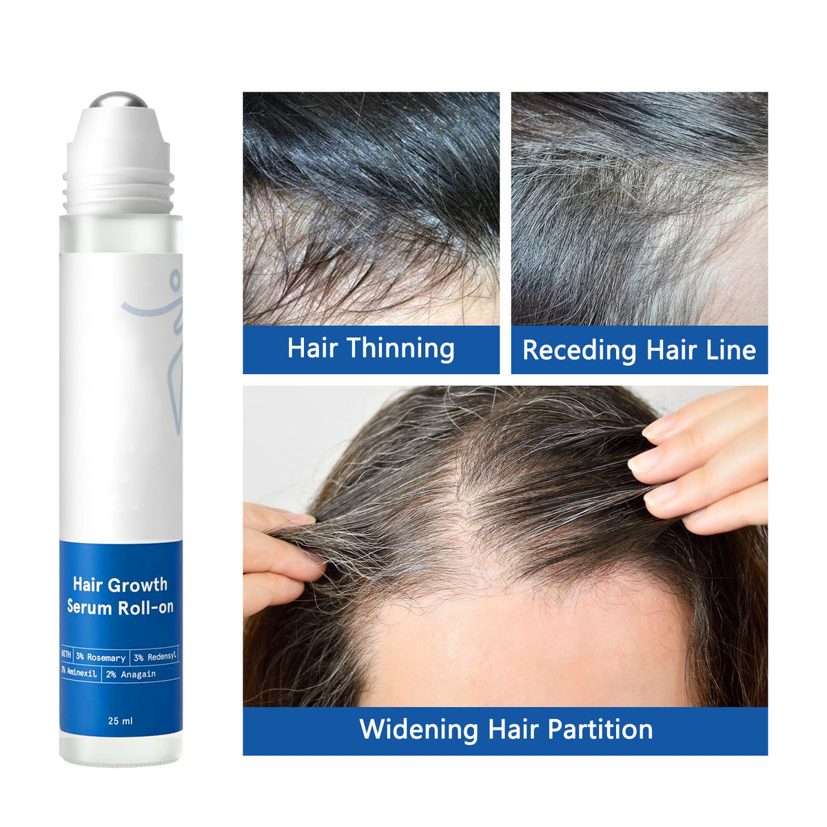 Advanced Hair Density Roll-On Serum